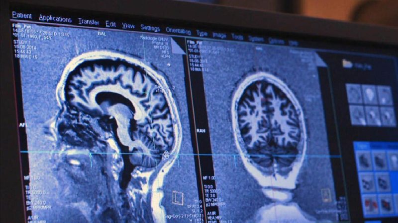 Trottinette électrique et alcoolémie : quelles sanctions et le retrait éventuel de votre permis